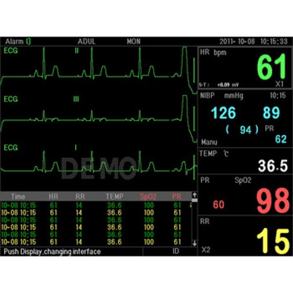 Μόνιτορ πολλαπλών παραμέτρων PC 3000 Multi Parameter Patient Monitor