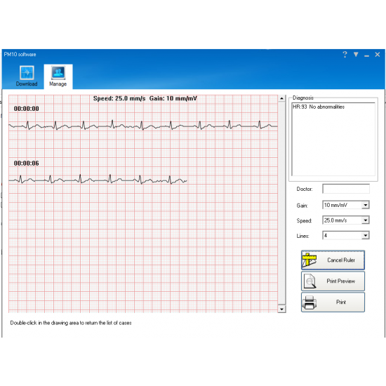 Καρδιογράφος τσέπης PM10 PALM ECG – με λογισμικό και Bluetooth