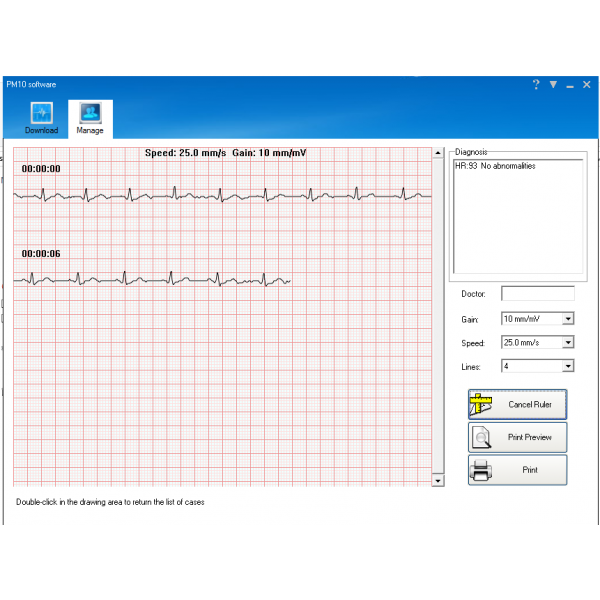 Καρδιογράφος τσέπης PM10 PALM ECG – με λογισμικό και Bluetooth