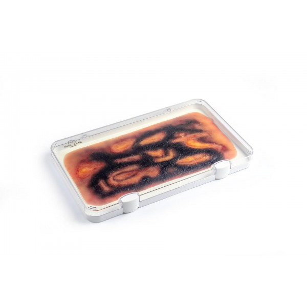 Wound Moulage "3rd Degree Burn" – Προσομοίωση Εγκαύματος 3ου Βαθμού 2