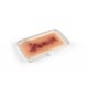 Wound Moulage "Hematoma Older" – Προσομοίωση Παλαιού Αιματώματος Wound Moulage "Hematoma Older" – Προσομοίωση Παλαιού Αιματώματος