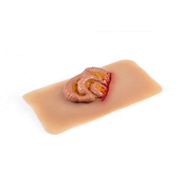 Wound Moulage "Protruding Small Intestines" – Προσομοίωση Εξόδου Λεπτού Εντέρου από Κοιλιακό Τραύμα Wound Moulage "Protruding Small Intestines" – Προσομοίωση Εξόδου Λεπτού Εντέρου από Κοιλιακό Τραύμα