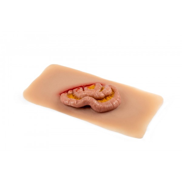Wound Moulage "Protruding Small Intestines" – Προσομοίωση Εξόδου Λεπτού Εντέρου από Κοιλιακό Τραύμα Wound Moulage "Protruding Small Intestines" – Προσομοίωση Εξόδου Λεπτού Εντέρου από Κοιλιακό Τραύμα