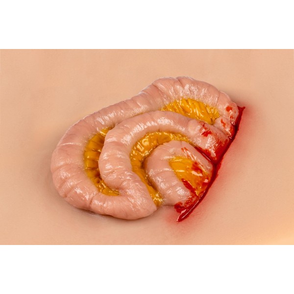 Wound Moulage "Protruding Small Intestines" – Προσομοίωση Εξόδου Λεπτού Εντέρου από Κοιλιακό Τραύμα Wound Moulage "Protruding Small Intestines" – Προσομοίωση Εξόδου Λεπτού Εντέρου από Κοιλιακό Τραύμα