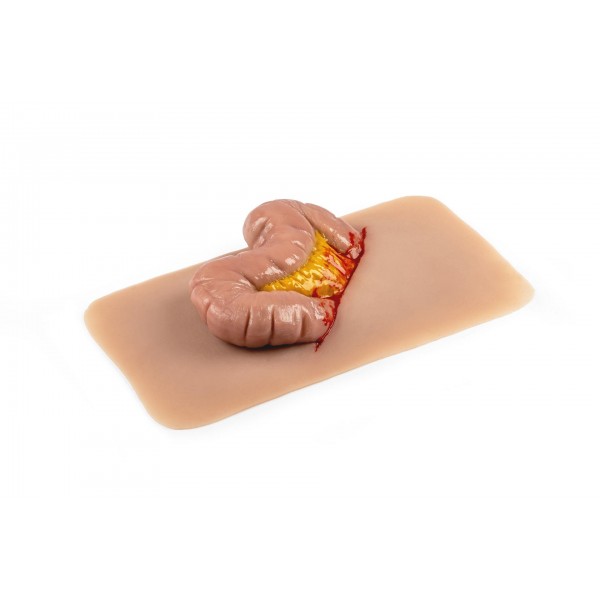 Wound Moulage "Protrusion of Large Intestines" – Προσομοίωση Εξόδου Εντέρου από Κοιλιακό Τραύμα Wound Moulage "Protrusion of Large Intestines" – Προσομοίωση Εξόδου Εντέρου από Κοιλιακό Τραύμα