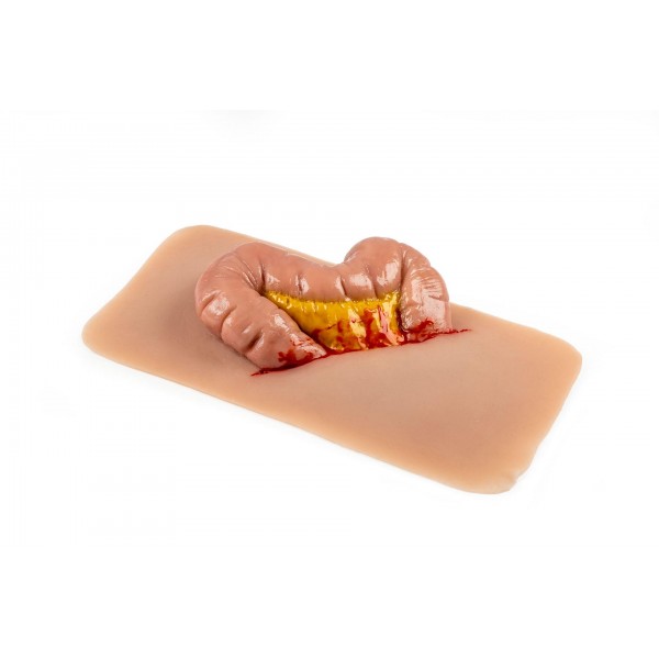 Wound Moulage "Protrusion of Large Intestines" – Προσομοίωση Εξόδου Εντέρου από Κοιλιακό Τραύμα Wound Moulage "Protrusion of Large Intestines" – Προσομοίωση Εξόδου Εντέρου από Κοιλιακό Τραύμα