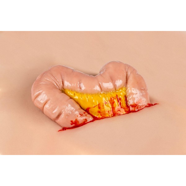 Wound Moulage "Protrusion of Large Intestines" – Προσομοίωση Εξόδου Εντέρου από Κοιλιακό Τραύμα Wound Moulage "Protrusion of Large Intestines" – Προσομοίωση Εξόδου Εντέρου από Κοιλιακό Τραύμα