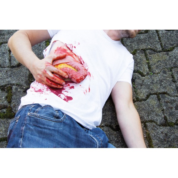 Wound Moulage "Protrusion of Large Intestines" – Προσομοίωση Εξόδου Εντέρου από Κοιλιακό Τραύμα Wound Moulage "Protrusion of Large Intestines" – Προσομοίωση Εξόδου Εντέρου από Κοιλιακό Τραύμα