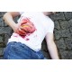 Wound Moulage "Protrusion of Large Intestines" – Προσομοίωση Εξόδου Εντέρου από Κοιλιακό Τραύμα Wound Moulage "Protrusion of Large Intestines" – Προσομοίωση Εξόδου Εντέρου από Κοιλιακό Τραύμα