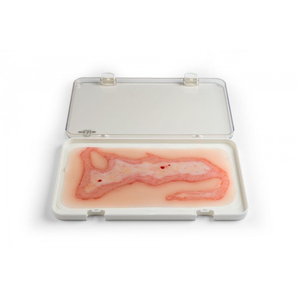 Wound Moulage "Scalding" – Προσομοίωση Εγκαύματος από Ζεστό Υγρό 2