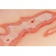 Wound Moulage "Scalding" – Προσομοίωση Εγκαύματος από Ζεστό Υγρό 2 Wound Moulage "Scalding" – Προσομοίωση Εγκαύματος από Ζεστό Υγρό 2