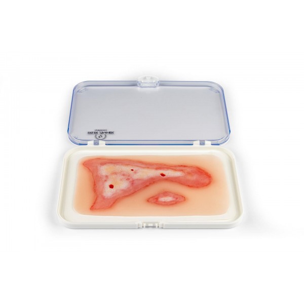 Wound Moulage "Scalding" – Προσομοίωση Εγκαύματος από Ζεστό Υγρό