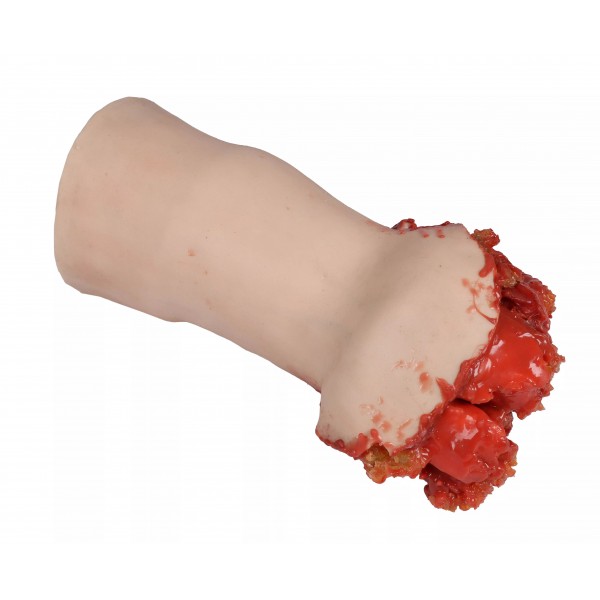 Amputated Leg Task Trainer – Εκπαιδευτικό Μοντέλο Ποδιού με Ακρωτηριασμό