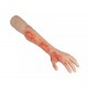 Arm with Burns Task Trainer – Εκπαιδευτικό Μοντέλο Χεριού με Εγκαύματα