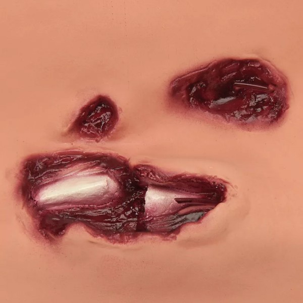 Casualty Simulation Set Basic – Βασικό Σετ Προσομοίωσης Τραυμάτων