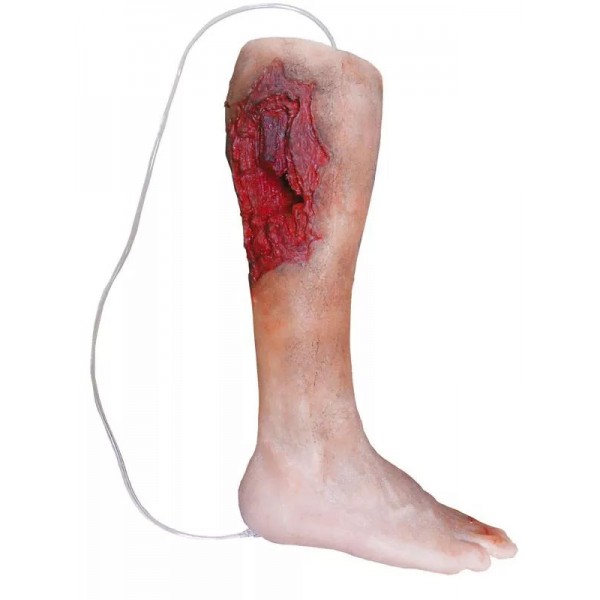 Emergency Lower Leg – Εκπαιδευτικό Μοντέλο Ποδιού με Τραύμα από Έκρηξη