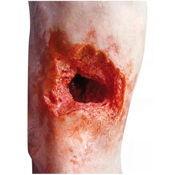 Emergency Leg – Εκπαιδευτικό Μοντέλο Ποδιού με Τραύματα από Έκρηξη και Πυροβολισμό
