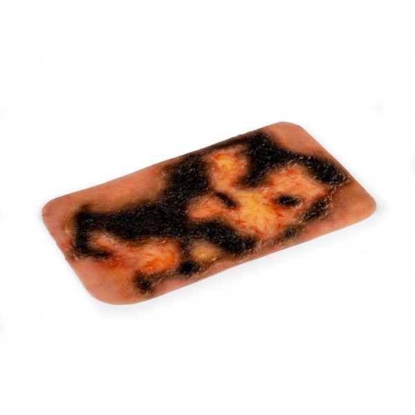 Wound Moulage "3rd Degree Burn" – Προσομοίωση Εγκαύματος 3ου Βαθμού