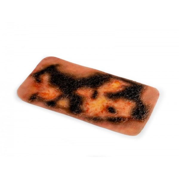 Wound Moulage "3rd Degree Burn" – Προσομοίωση Εγκαύματος 3ου Βαθμού