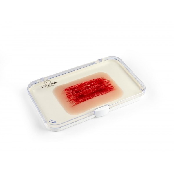 Wound Moulage "Abrasion" – Προσομοίωση Εκδοράς