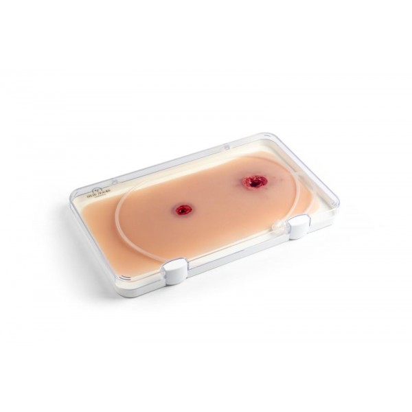 Wound Moulage – Τραύμα από Σφαίρα στο Χέρι με Λειτουργία Αιμορραγίας