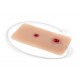 Wound Moulage – Τραύμα από Σφαίρα στο Χέρι με Λειτουργία Αιμορραγίας Wound Moulage – Τραύμα από Σφαίρα στο Χέρι με Λειτουργία Αιμορραγίας