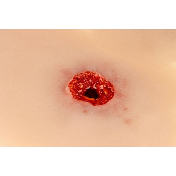 Wound Moulage – Τραύμα από Σφαίρα στο Χέρι με Λειτουργία Αιμορραγίας Wound Moulage – Τραύμα από Σφαίρα στο Χέρι με Λειτουργία Αιμορραγίας