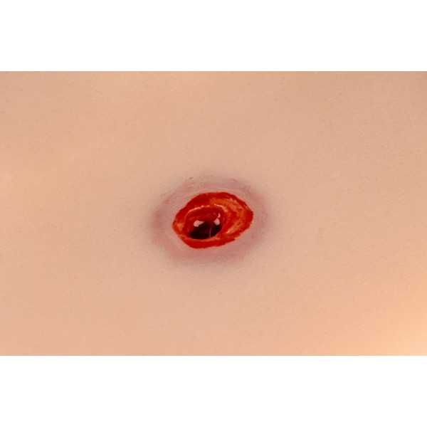 Wound Moulage – Τραύμα από Σφαίρα στο Χέρι με Λειτουργία Αιμορραγίας Wound Moulage – Τραύμα από Σφαίρα στο Χέρι με Λειτουργία Αιμορραγίας