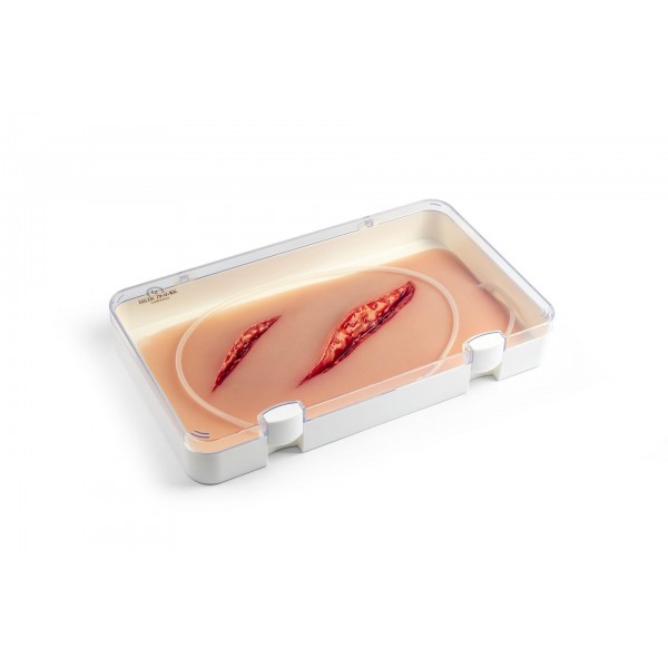 Wound Moulage – Μεγάλο Κόψιμο με Λειτουργία Αιμορραγίας