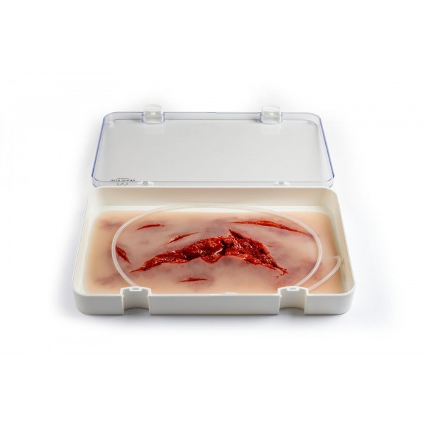 Wound Moulage – Μεγάλη Ρήξη Δέρματος με Λειτουργία Αιμορραγίας