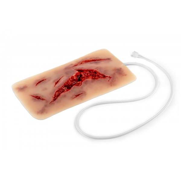 Wound Moulage – Μεγάλη Ρήξη Δέρματος με Λειτουργία Αιμορραγίας Wound Moulage – Μεγάλη Ρήξη Δέρματος με Λειτουργία Αιμορραγίας