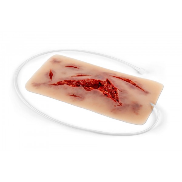 Wound Moulage – Μεγάλη Ρήξη Δέρματος με Λειτουργία Αιμορραγίας Wound Moulage – Μεγάλη Ρήξη Δέρματος με Λειτουργία Αιμορραγίας