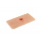Wound Moulage – Ανοιχτό Κάταγμα Οστού Άνω Άκρου με Λειτουργία Αιμορραγίας Wound Moulage – Ανοιχτό Κάταγμα Οστού Άνω Άκρου με Λειτουργία Αιμορραγίας