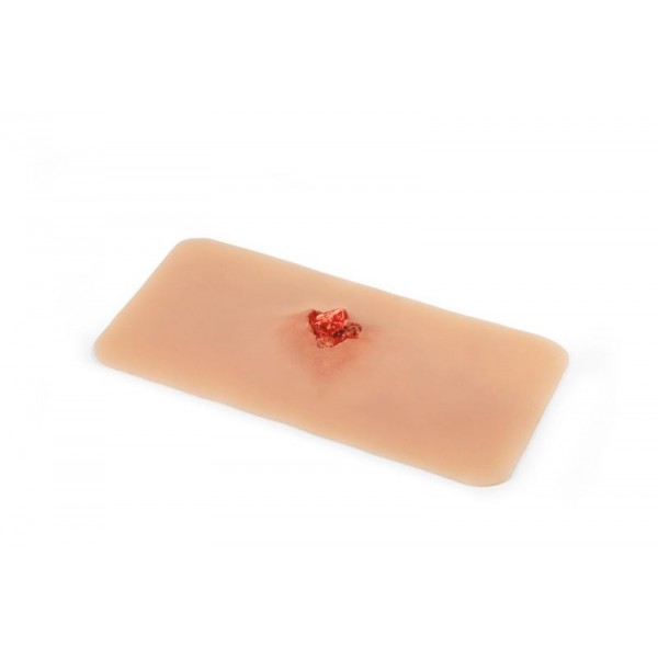 Wound Moulage – Ανοιχτό Κάταγμα Οστού Άνω Άκρου με Λειτουργία Αιμορραγίας Wound Moulage – Ανοιχτό Κάταγμα Οστού Άνω Άκρου με Λειτουργία Αιμορραγίας