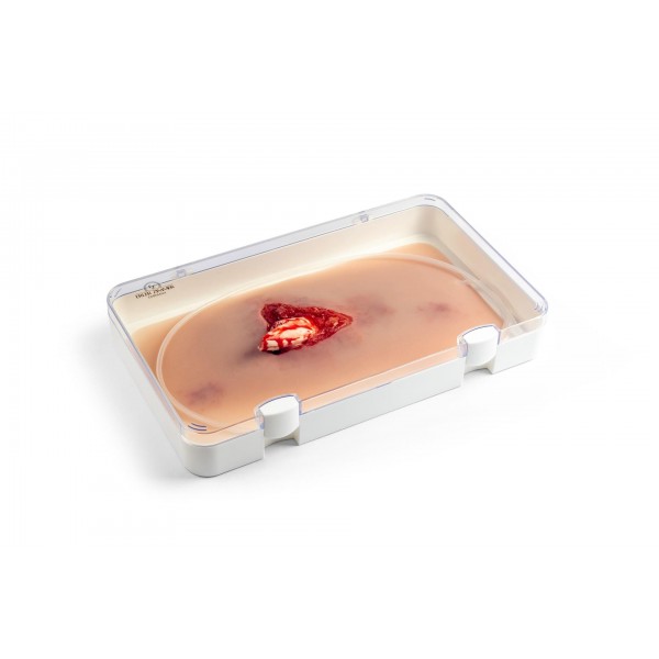 Wound Moulage – Ανοιχτό Κάταγμα Ποδιού με Λειτουργία Αιμορραγίας