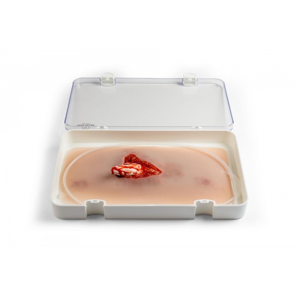 Wound Moulage – Ανοιχτό Κάταγμα Ποδιού με Λειτουργία Αιμορραγίας