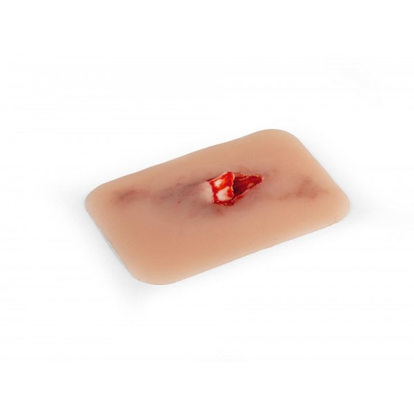 Wound Moulage "Open Fracture" – Προσομοίωση Ανοιχτού Κατάγματος Wound Moulage "Open Fracture" – Προσομοίωση Ανοιχτού Κατάγματος