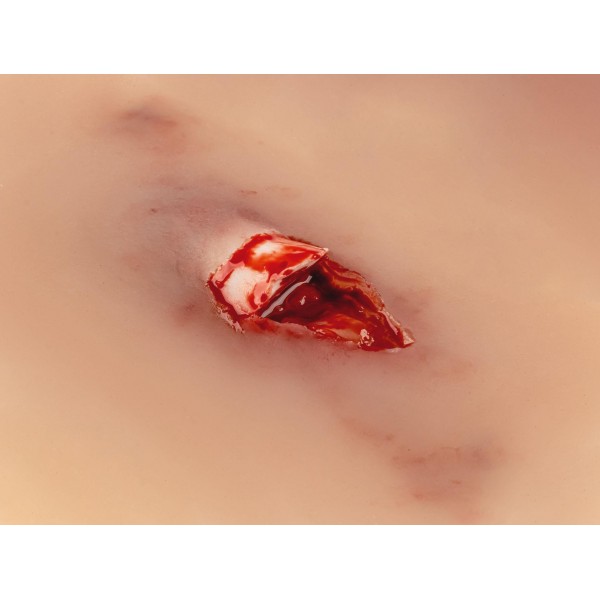 Wound Moulage "Open Fracture" – Προσομοίωση Ανοιχτού Κατάγματος Wound Moulage "Open Fracture" – Προσομοίωση Ανοιχτού Κατάγματος