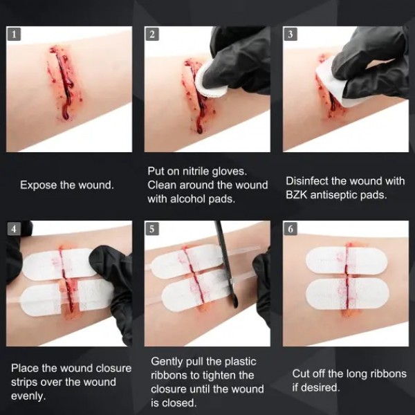 Rhino Rescue Κιτ Τραυμάτων και Πληγών - Wound Closure Kit