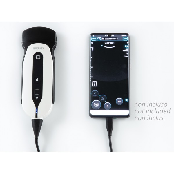 SONOEYE P5 DIGITAL COLOUR DOPPLER - Convex Probe