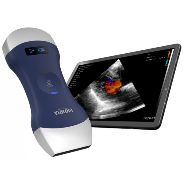  VIATOM DUAL HEAD LINEAR/CONVEX WIRELESS PORTABLE ULTRASOUND