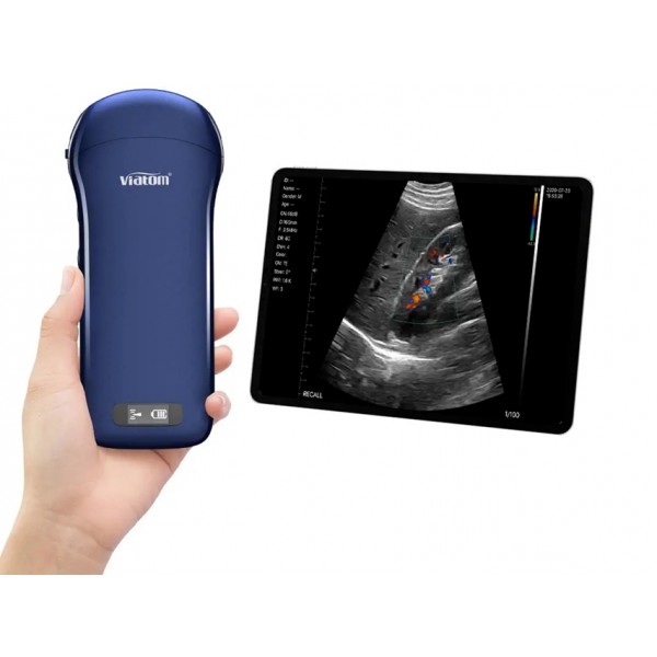 VIATOM 3 IN 1 LINEAR/CONVEX/CARDIAC WIRELESS PORTABLE ULTRASOUND
