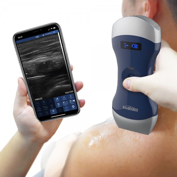 VIATOM DUAL HEAD LINEAR/CONVEX WIRELESS PORTABLE ULTRASOUND