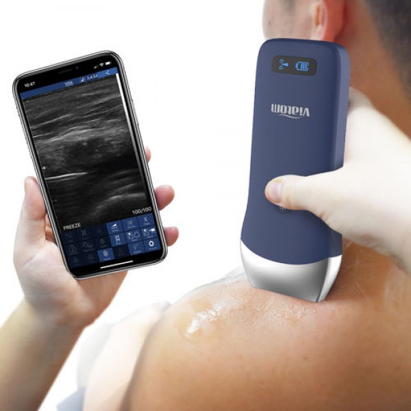 VIATOM LINEAR WIRELESS PORTABLE ULTRASOUND