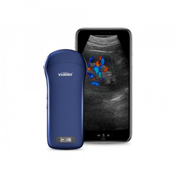 VIATOM 3 IN 1 LINEAR/CONVEX/CARDIAC WIRELESS PORTABLE ULTRASOUND