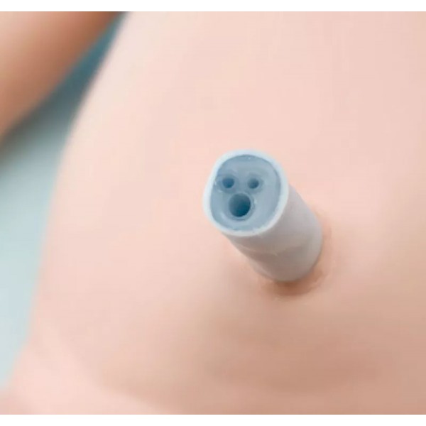 Νεογνό για Διασωλήνωση και Αναζωογόνηση (Intubation- and Reanimation Neonate) Νεογνό για Διασωλήνωση και Αναζωογόνηση (Intubation- and Reanimation Neonate)
