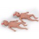 NENA Sim Preemie Xact – Προσομοιωτής Πρόωρου Νεογνού