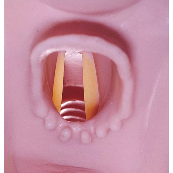 Airway Larry – Εκπαιδευτής αεραγωγού για R10052