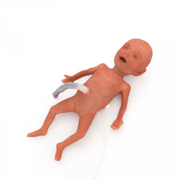 NENA Sim Preemie Xcel – Προσομοιωτής Πρόωρου Νεογνού