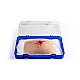 Wound Moulage "Shot Groin, Wound Packing" – Προσομοίωση Τραύματος από Πυροβολισμό στη Βουβωνική Περιοχή με Δυνατότητα Επικάλυψης Τραύματος Wound Moulage "Shot Groin, Wound Packing" – Προσομοίωση Τραύματος από Πυροβολισμό στη Βουβωνική Περιοχή με Δυνατότητα Επικάλυψης Τραύματος